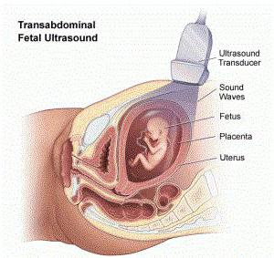 uzi ilk üç aylık dönemi için tarama sonuçları