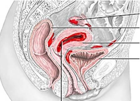 uterusun endometriyozunda halk tedavisi