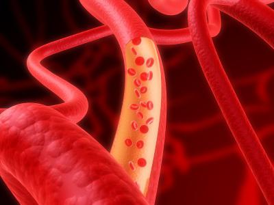 Lipidogram - nedir? Bir lipidogramın nasıl okunur?