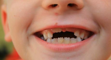 Bebeğiniz diş kaçıyor kaç yıldır?