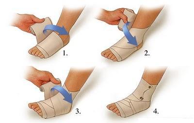 sol ayak bileği ligamentlerine hasar