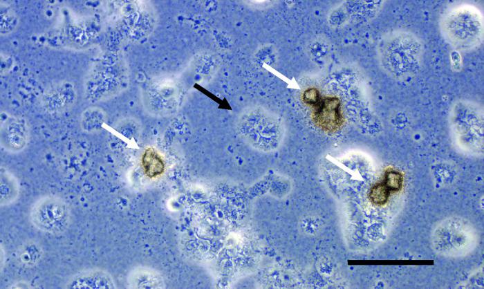 ureaplasma urealitikum nedir 