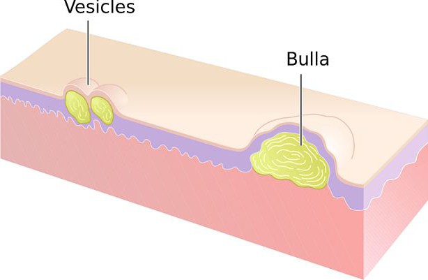 veziküller bunlar